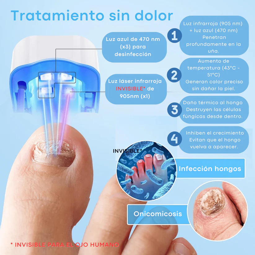 Muestra tus Pies Sin Esconder nada - Láser para Hongos en las Uñas